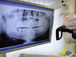 Dental x-ray on the monitor