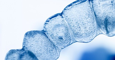Illustration of a close-up of a clear aligner