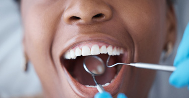 Close-up of patient’s mouth during dental checkup