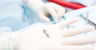 Gloved hand holding a dental implant in Odessa, TX