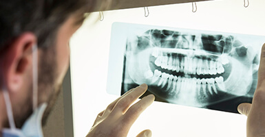 Man looking at a dental x-ray